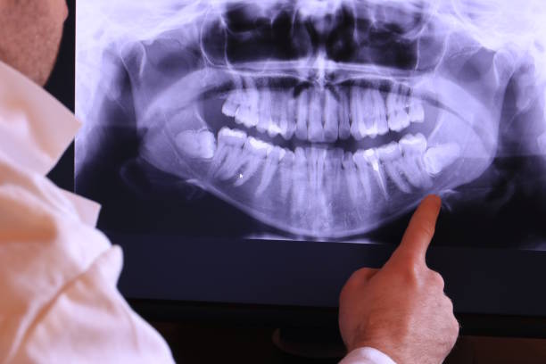 Best Emergency Dental Care for Broken or Chipped Teeth in Hialeah Gardens, FL